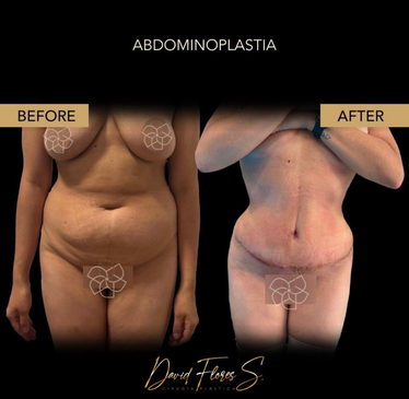 Slider image (3) Dr. David Flores Soto - DFS Plastic Surgery